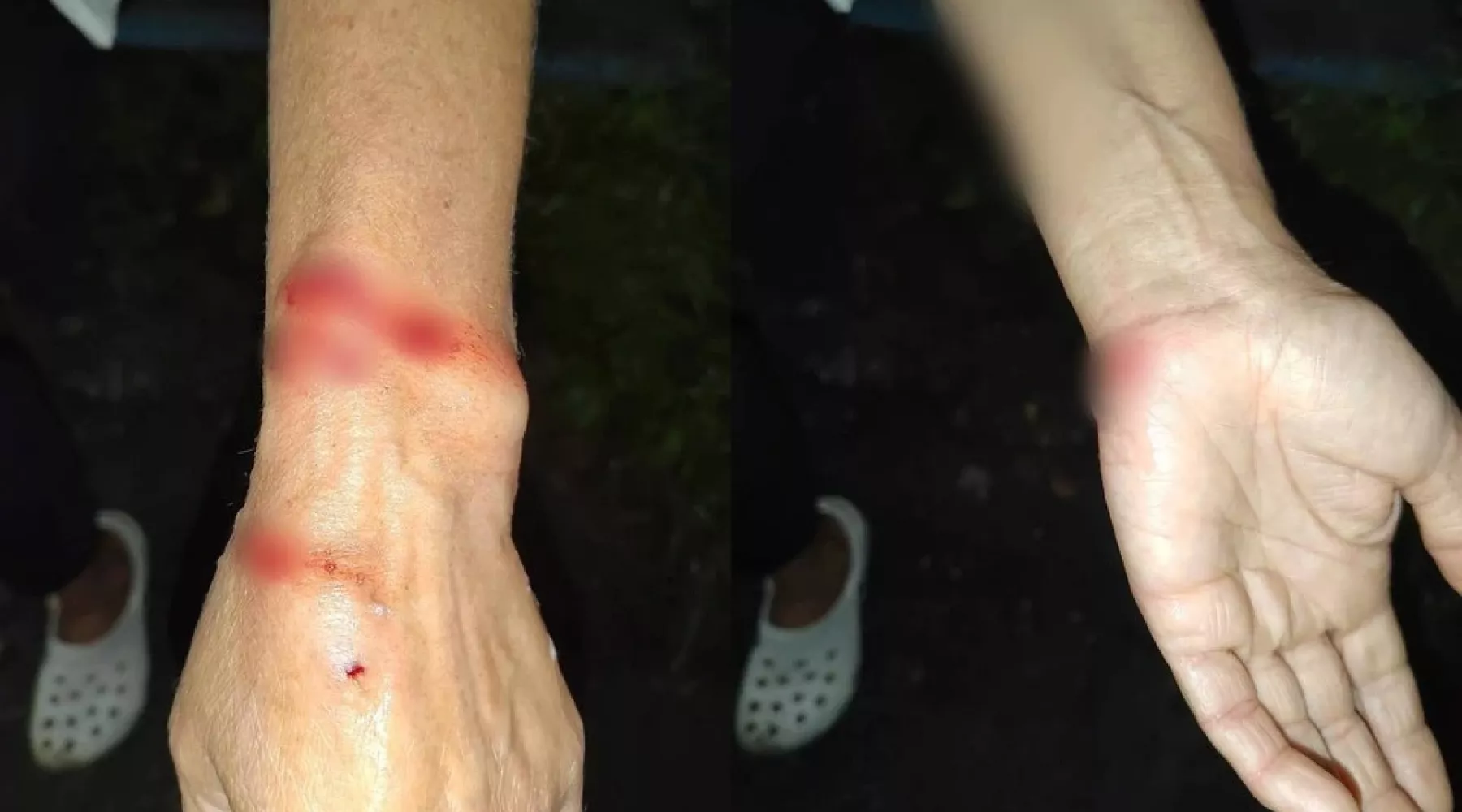 Собака напала на женщину в Новосибирске