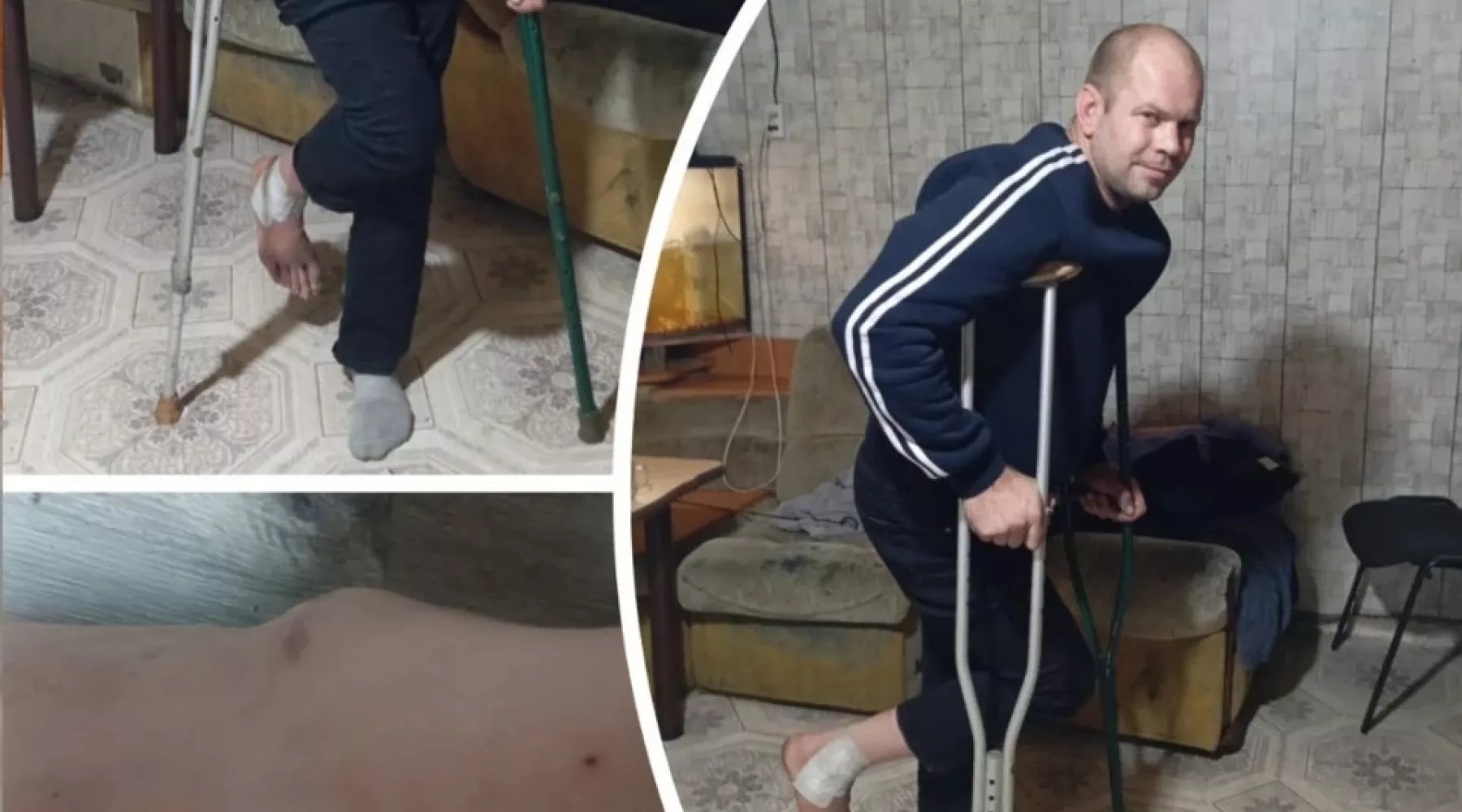 Сибиряк обвинил частную клинику в некачественной операции на ноге