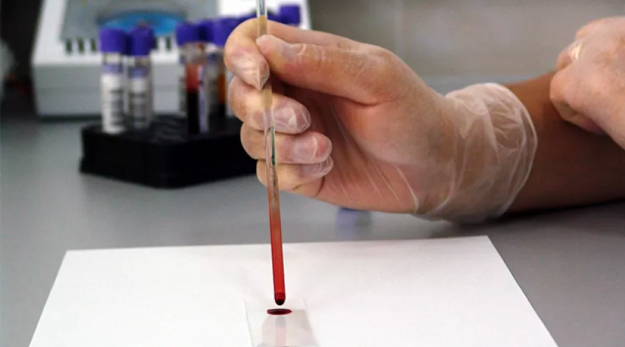 Медики призывают бийчан стать донорами крови 