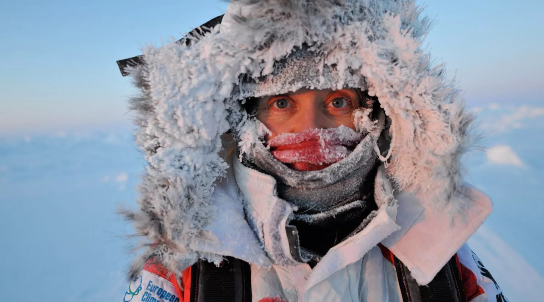 В Алтайском крае из-за морозов перегружены травмпункты