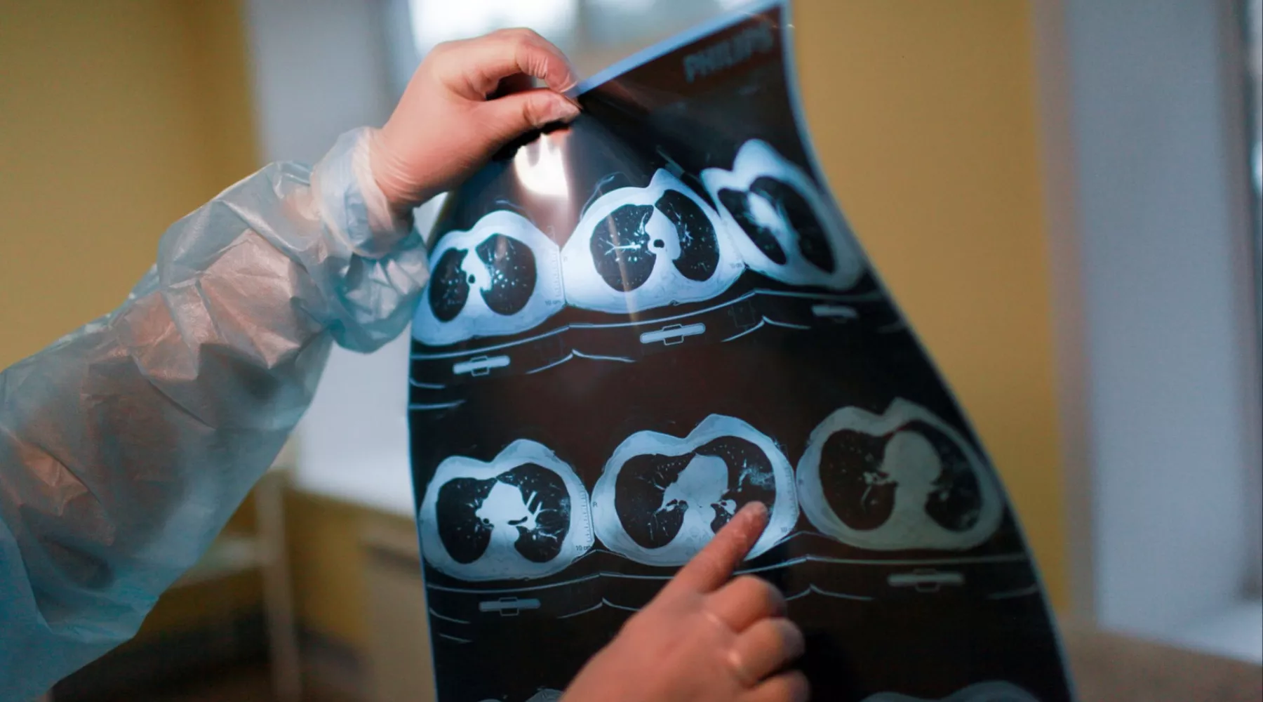 О жизни и смерти: почему в Алтайском крае такая высокая смертность от COVID-19