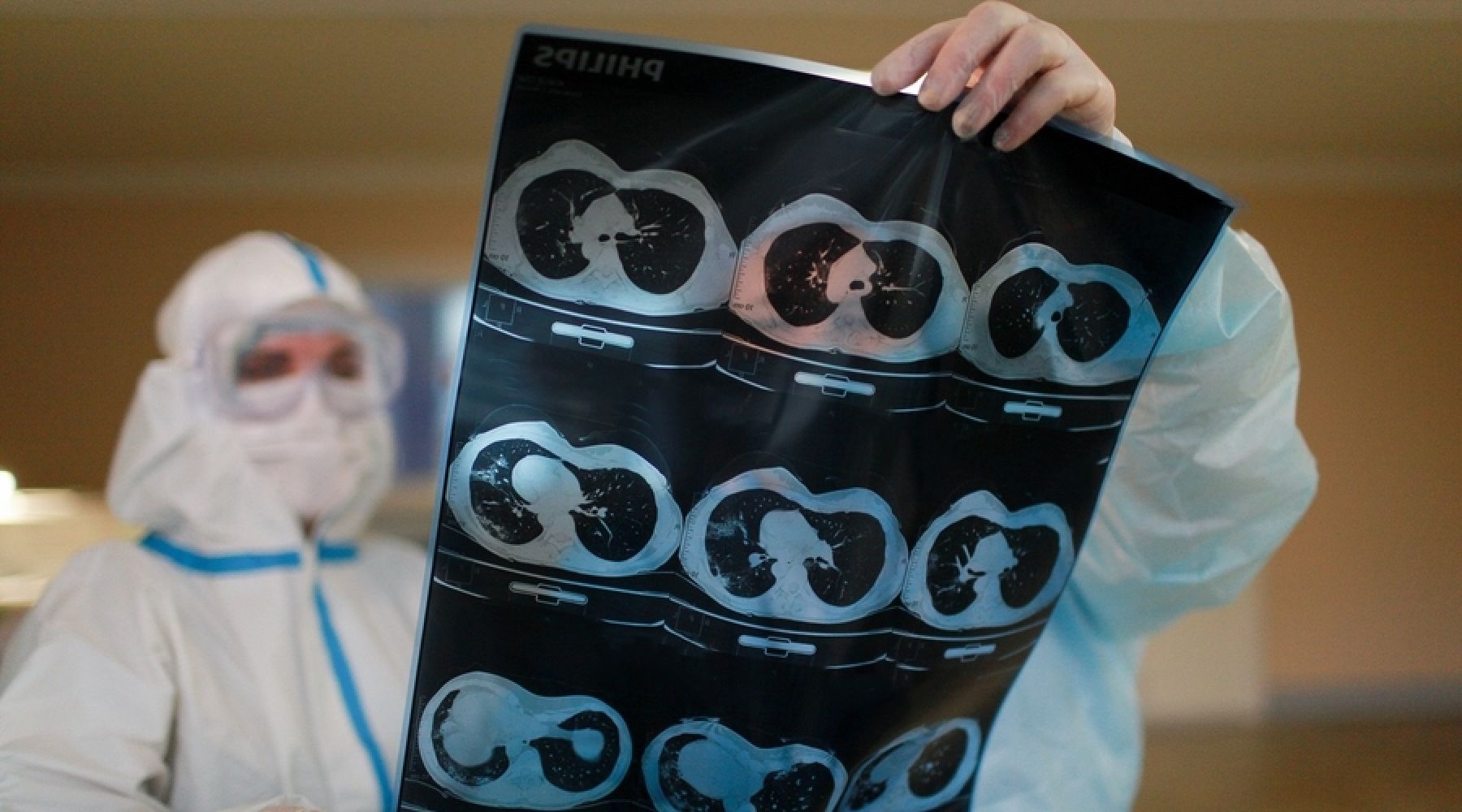 Инфекционистам Бийской ЦГБ пообещали начислить новые ковидные выплаты